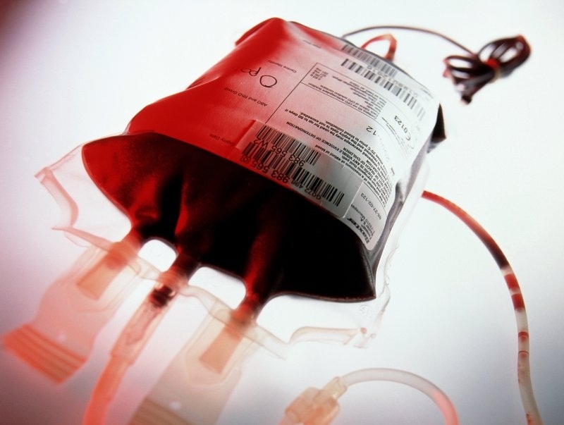 مدیر عامل سازمان انتقال خون از اهدای سه برابری خون در ایام تاسوعا و عاشورا خبر داد